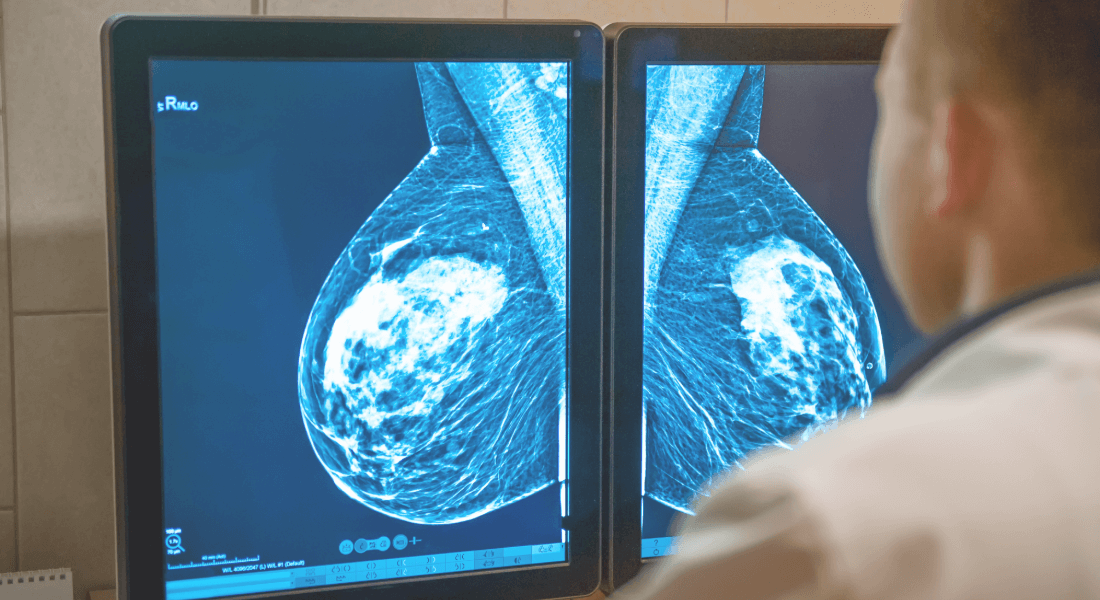 Doctor analyzing screening images Doctor analyzing screening images